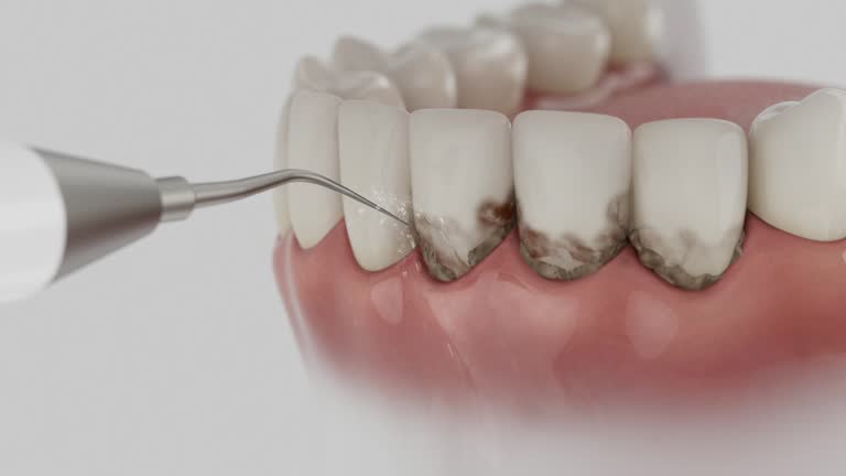 Trusted Dental Crowns And Bridges service in Chickamauga, GA - Dentist Open Now